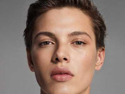 济南市桂敏硕整形医生男子脱发治疗效果及手术价格