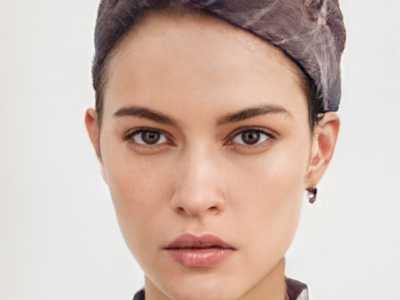 泸州微针植发哪家强？2026最新避坑指南，价格案例一次捋清！